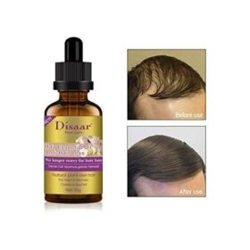 Sérum Capillaire Anti-Chute au Gingembre – Pousse Rapide des Cheveux et Barbe – 100% Naturel – 30ml – Image 2