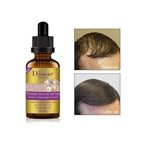 Sérum Capillaire Anti-Chute au Gingembre – Pousse Rapide des Cheveux et Barbe – 100% Naturel – 30ml Sérum Capillaire Anti-Chute au Gingembre – Pousse Rapide des Cheveux et Barbe – 100% Naturel – 30ml