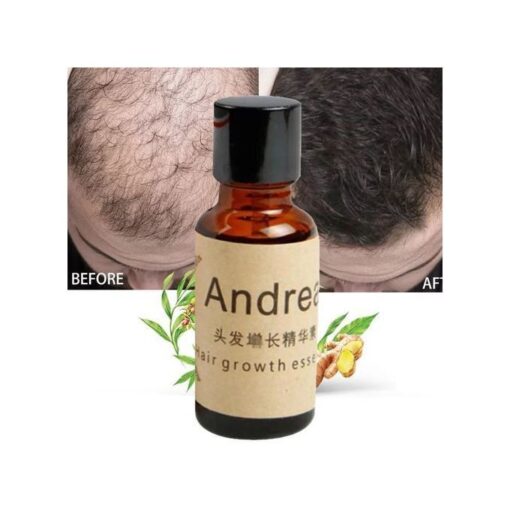Huile Essentielle à Base de Plantes – Croissance Barbe et Cheveux, 20ml Huile Essentielle à Base de Plantes – Croissance Barbe et Cheveux, 20ml