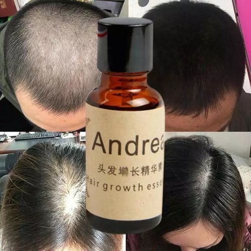 Huile Essentielle à Base de Plantes – Croissance Barbe et Cheveux, 20ml Huile Essentielle à Base de Plantes – Croissance Barbe et Cheveux, 20ml
