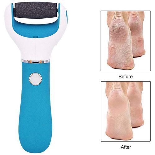 Râpe à Pieds Électrique Rechargeable – Anti-Callosités & Peau Morte – Soin des Pieds à Domicile Râpe à Pieds Électrique Rechargeable – Anti-Callosités & Peau Morte – Soin des Pieds à Domicile