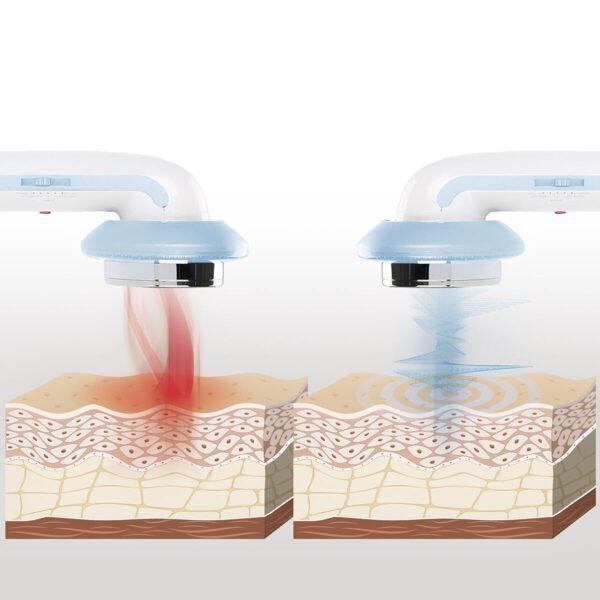 Masseur Anti-cellulite à Cavitation par Ultrasons avec Infrarouge et Électrostimulation 3 en 1 CellyMax Masseur Anti-cellulite à Cavitation par Ultrasons avec Infrarouge et Électrostimulation 3 en 1 CellyMax