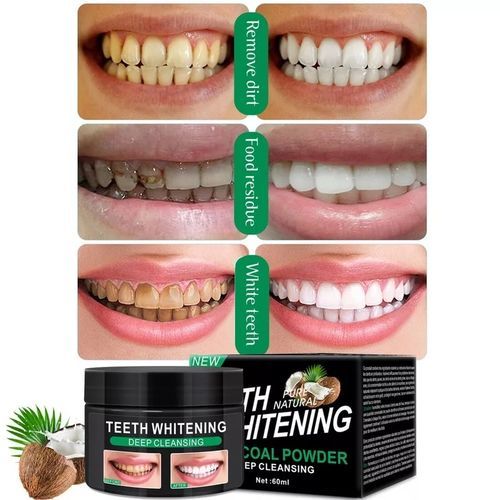 Poudre de Blanchiment des Dents au Charbon Actif – Charbon de Bambou 60 ml – Élimine les Taches et la Plaque Dentaire