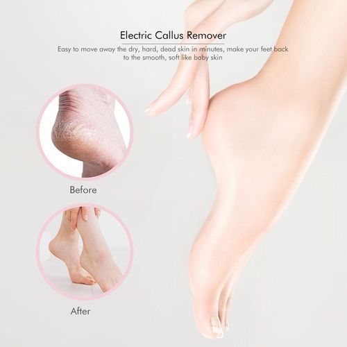 Râpe à Pieds Électrique Rechargeable – Anti-Callosités & Peau Morte – Soin des Pieds à Domicile Râpe à Pieds Électrique Rechargeable – Anti-Callosités & Peau Morte – Soin des Pieds à Domicile