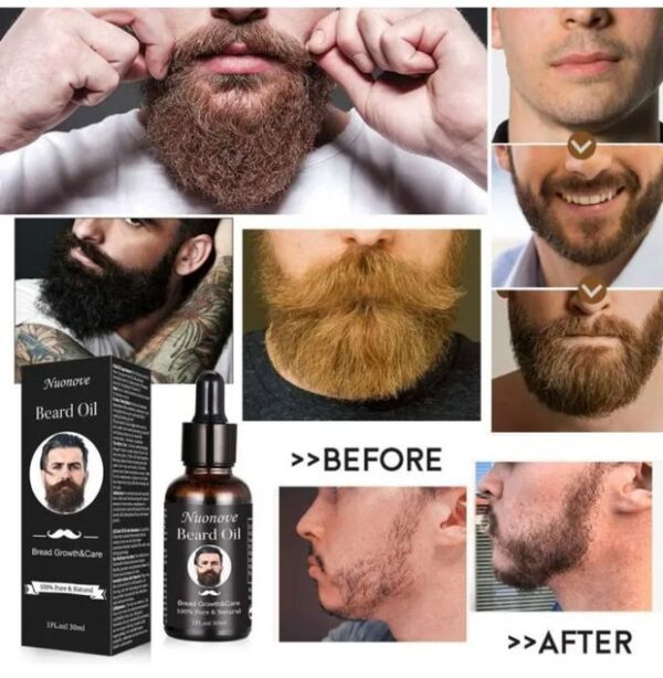 Huile de Croissance Rapide Barbe & Cheveux – Stimulation & Nutrition Huile de Croissance Rapide Barbe & Cheveux – Stimulation & Nutrition