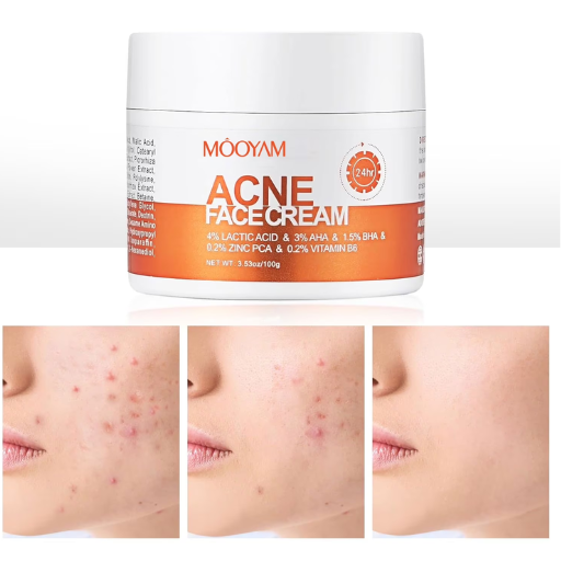 Crème visage anti‑acné 24h Mooyam – 100g