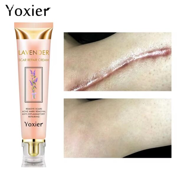 Crème réparatrice Yoxier Lavender — Soin anti‑taches & cicatrices