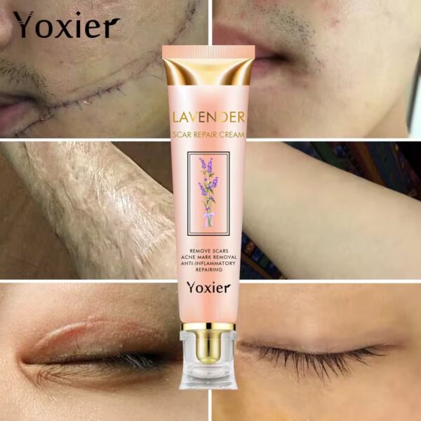 Crème réparatrice Yoxier Lavender — Soin anti‑taches & cicatrices