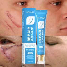 Gel anti‑cicatrice-Sadoer Aloe Vera Gel — hydratant et apaisant – Image 2