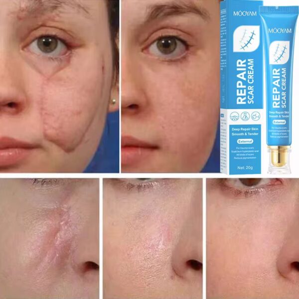 Gel anti‑cicatrice-Sadoer Aloe Vera Gel — hydratant et apaisant