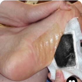 Kinoki Patch Détox Plantaires — 10 patchs (application nocturne) – Image 5