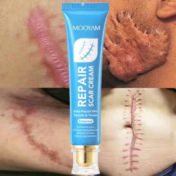 Gel anti‑cicatrice-Sadoer Aloe Vera Gel — hydratant et apaisant